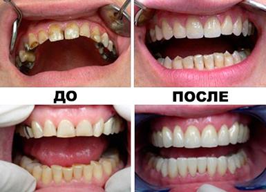Стоматологическая клиника "Биодент" Павлодар